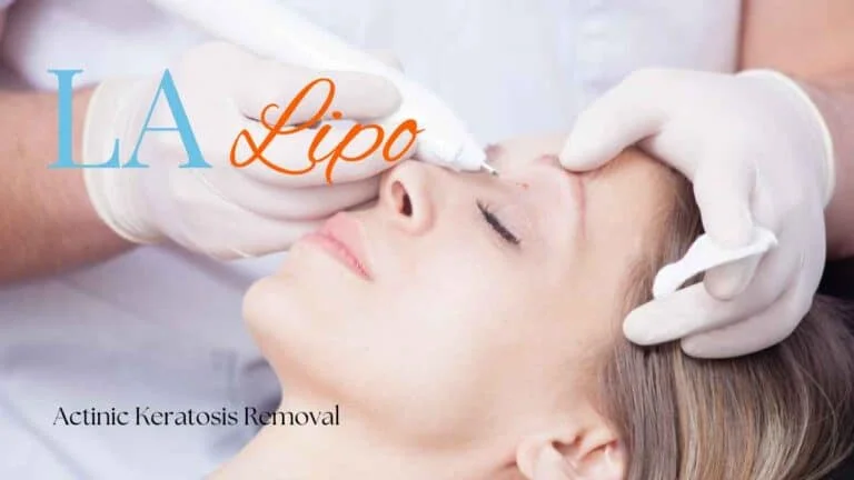 Woman receiving Actinic Keratosis Removal Treatment Dagenham